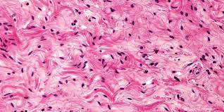 Resultado de imagen para tejido conjuntivo denso